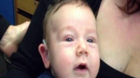ΑΠΙΣΤΕΥΤΟ! Μωρό με προβλήματα ακοής ακούει για πρώτη φορά τους γονείς του!