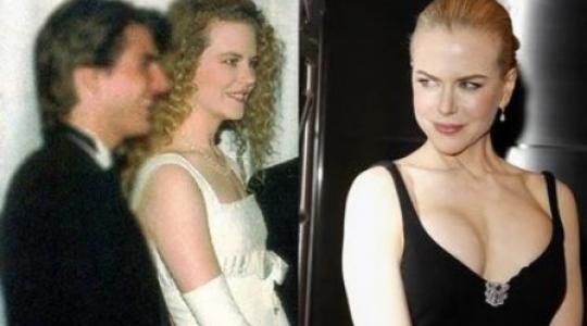 Έβγαλε μάτι το νέο στήθος της Nicole Kidman!