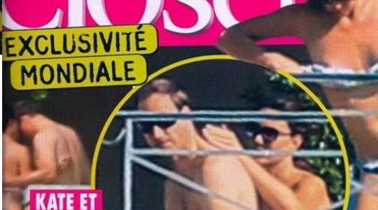 Σκάνδαλο: H Kate Middleton… topless!!