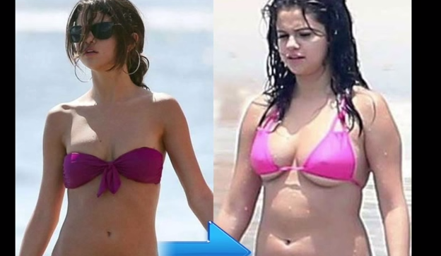 Γιατί η Selena Gomez πάχυνε;